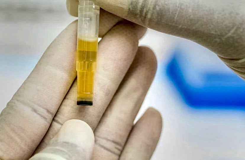 Wanita dakwa air kencing mampu sembuhkan rabun