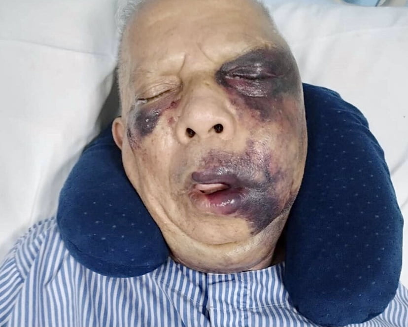 Lelaki warga emas cedera di muka dibelasah pembuli jalan