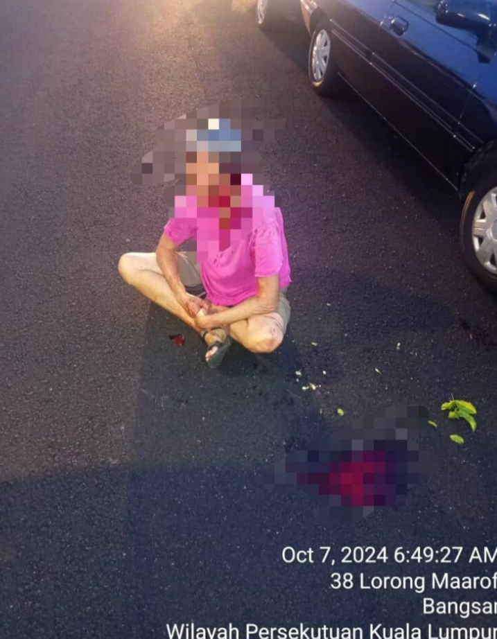 Wanita warga emas cedera parah akibat diragut