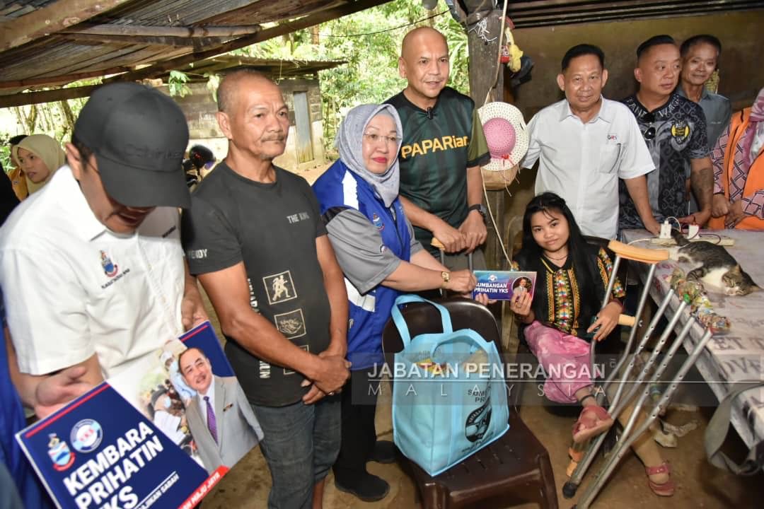 Rosnah dapat kaki palsu baharu, bantuan RM450