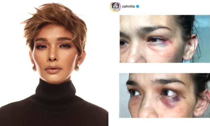 Suami Zahnita Wilson ditahan polis