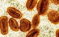 China kesan kumpulan strain Mpox baharu