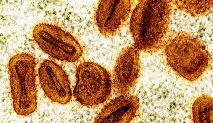 China kesan kumpulan strain Mpox baharu