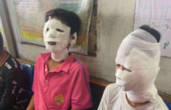 Murid cedera terkena percikan api masa guru buat eksperimen sains