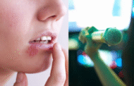 Wanita dakwa dijangkiti virus Herpes melalui mikrofon karaoke