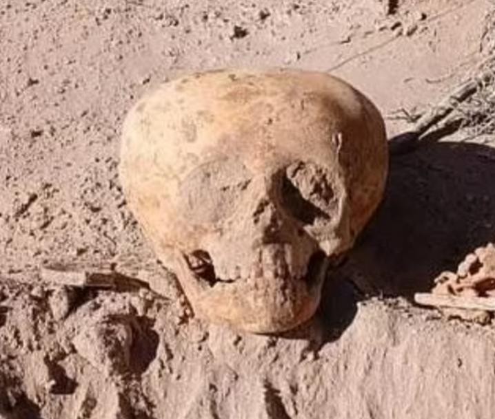 Penemuan tengkorak berbentuk aneh cetus tanda tanya