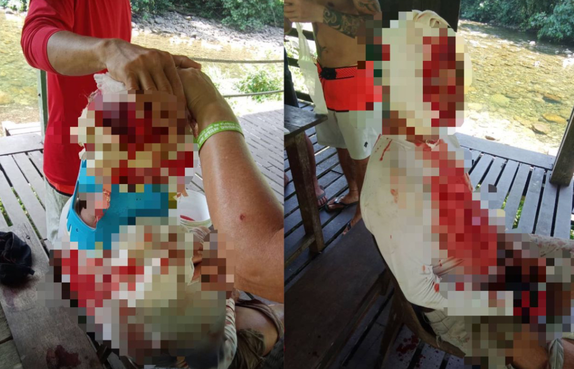 Pendaki warga emas cedera teruk di kepala selepas terjatuh 500 meter di Gunung Api