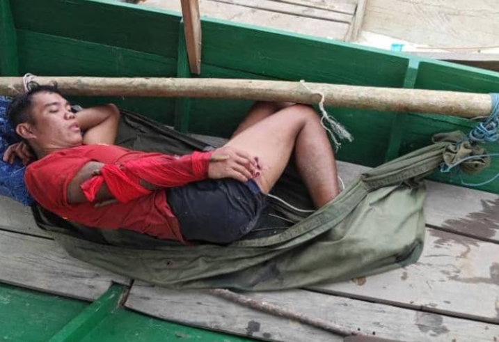 Lelaki cucuk mata buaya untuk selamatkan diri