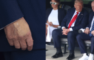 Trump alami masalah salur darah kronik, tapi tiada masalah jantung