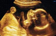 Teknologi AI bantu ramal tarikh tepat kelahiran bayi