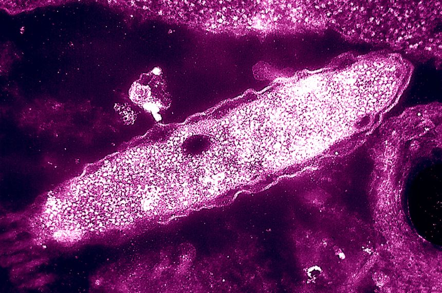 New York diserang wabak Legionnaires