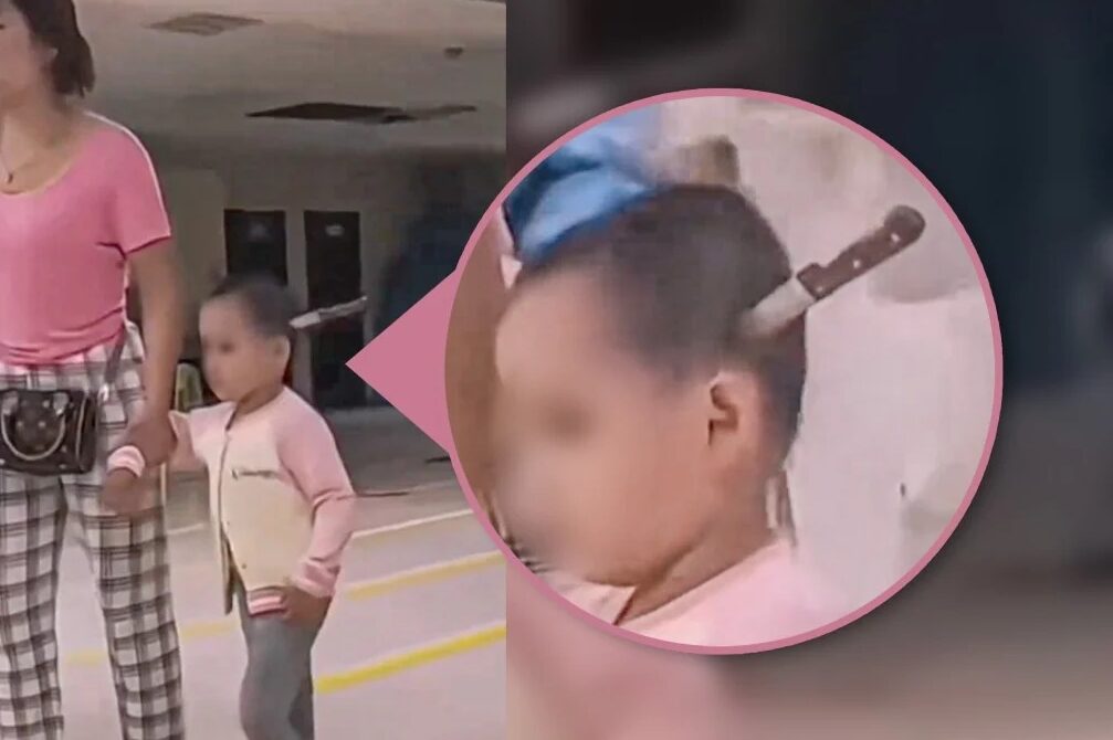 Wanita tenang bawa anak tiga tahun ke hospital dengan pisau tertusuk di kepala