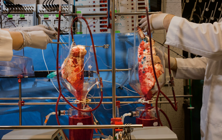 Saintis China pindahkan paru-paru babi ke tubuh manusia