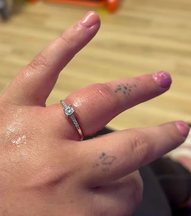 Wanita hampir hilang jari selepas cincin tunang tersekat